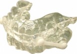 Anti Snoring Device
