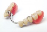 The GDC’s hidden policy on illegal dental devices
