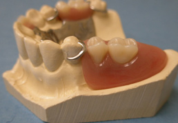 partial-dentures