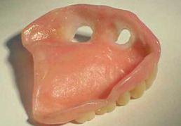 temporary-dentures