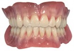 Smoking slows down healing in lower jaw after implants